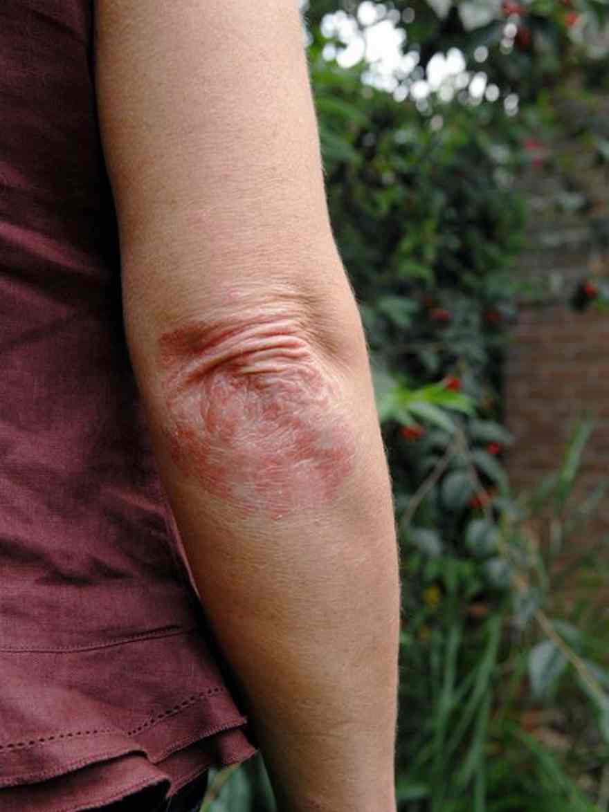 5 Habits That Might Be Making Your Pores and skin Worse